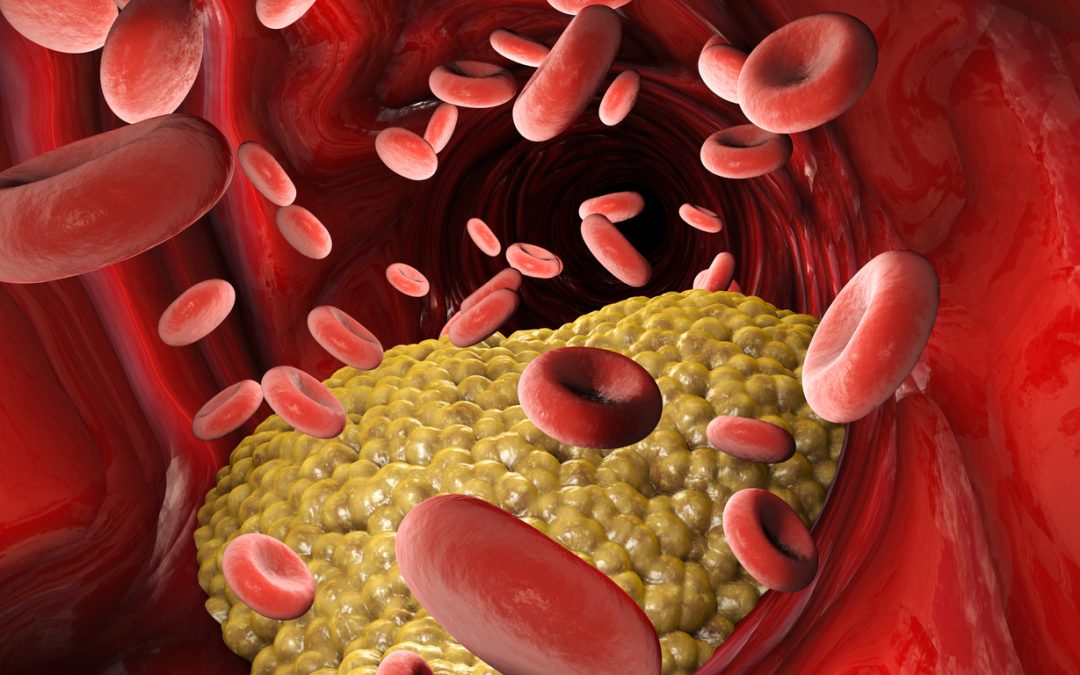 How to lower your triglycerides