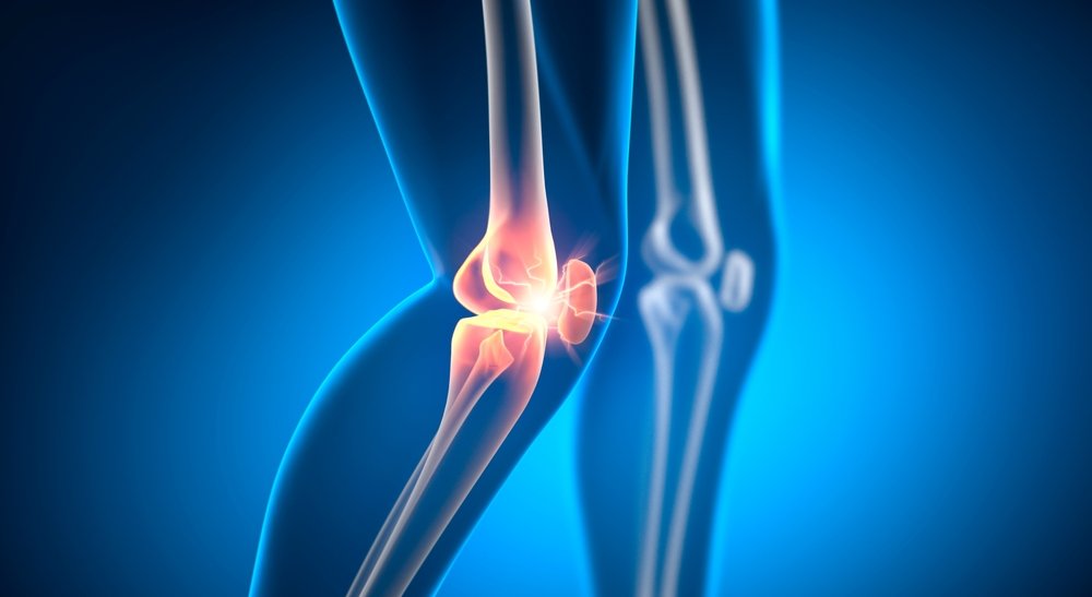 A 3D illustration of pain in the knee joint.