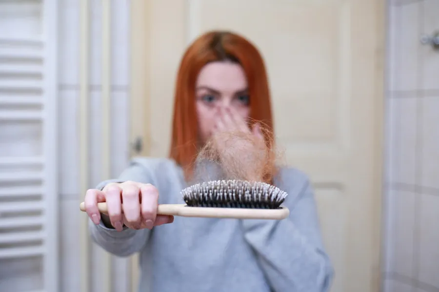 Woman holding a hairbrush filled with shed hair, showing concern about thinning hair or hair loss.