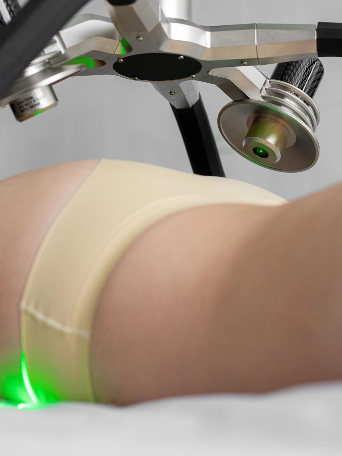 A person lying prone, receiving Emerald Laser body contouring treatment for non-invasive fat reduction.